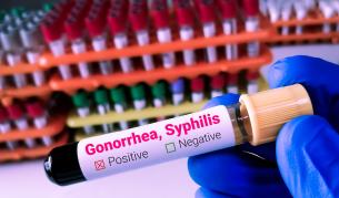 Бум на сифилис и гонорея в Гърция