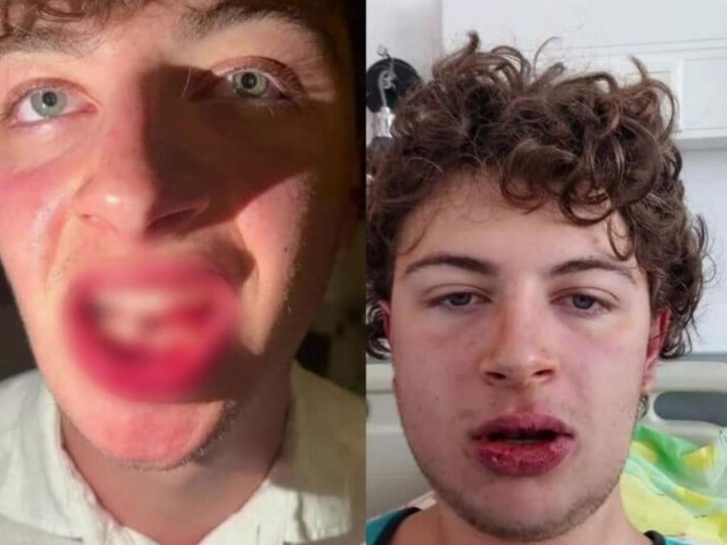 Полицай е счупил челюстта на 19 годишния студент от София Това