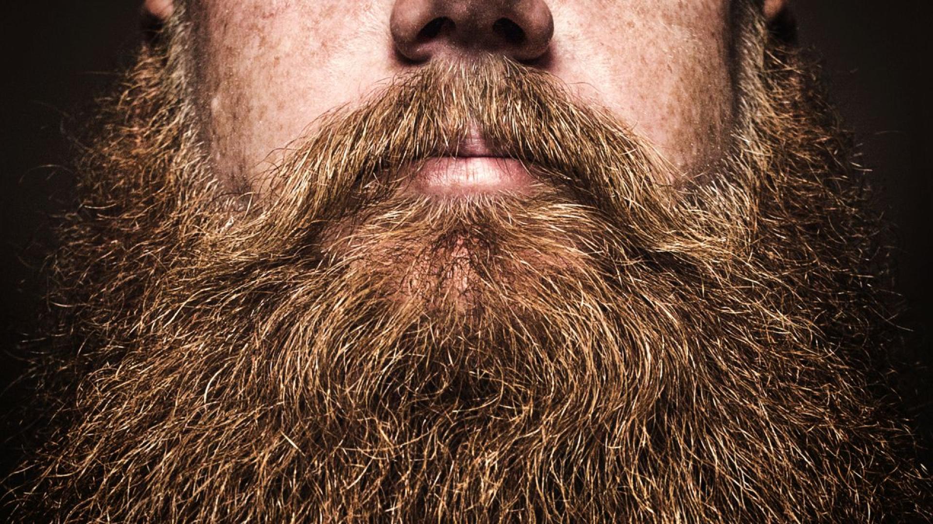 Млад мъж от Индия който страда от рядкото заболяване хипертрихоза причиняващо