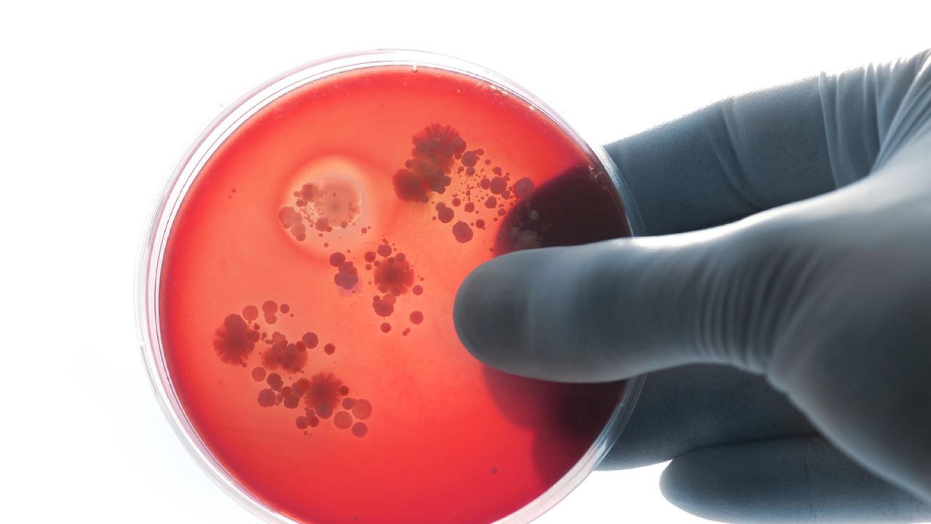 Изкуственият интелект е създал два нови потенциални антибиотика които могат