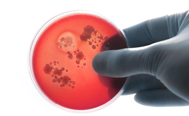 AI създаде антибиотици за гонорея и супербактерии MRSA