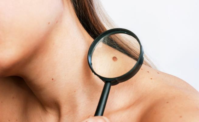 Митове за рака, в които е време да спрем да вярваме