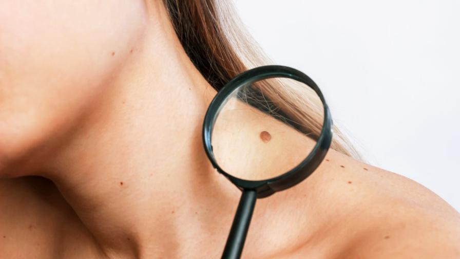 Митове за рака, в които е време да спрем да вярваме