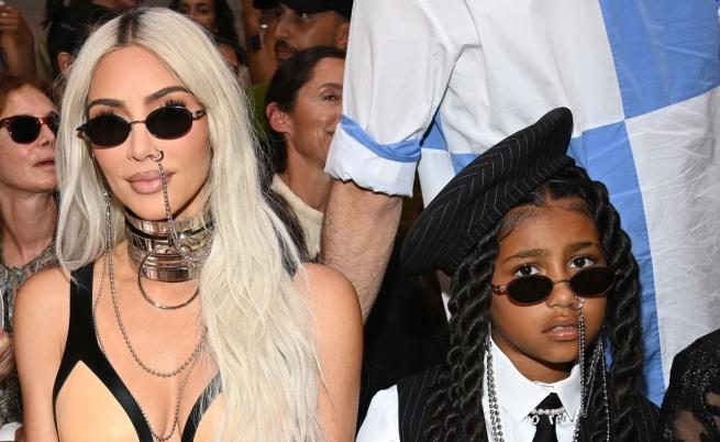 Дъщерята на Ким Кардашиян предизвика вълна от имитации и тревога сред стоматолозите с опасна TikTok мода