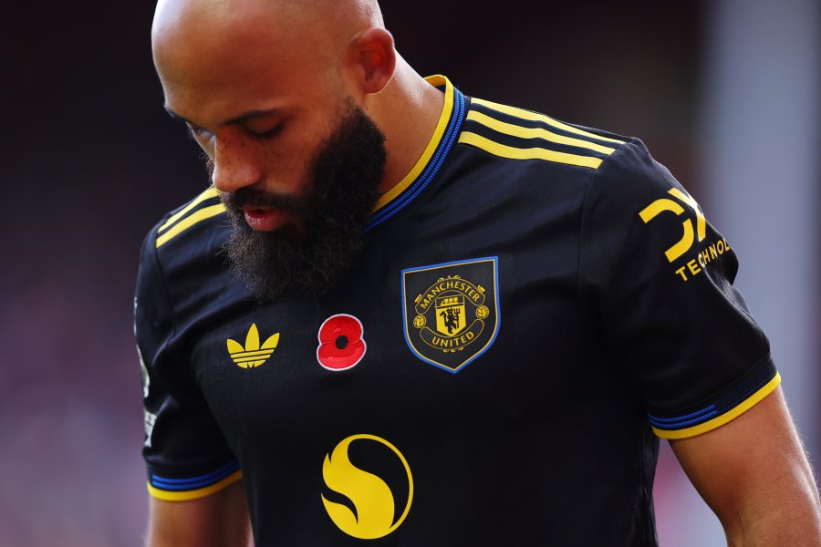 Нотингам Форест Манчестър Юнайтед1