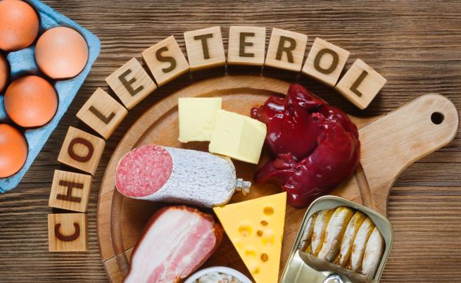 4 неочаквани причини за висок холестерол