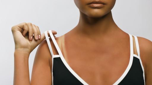 Бронзовият тен може да е симптом на рак