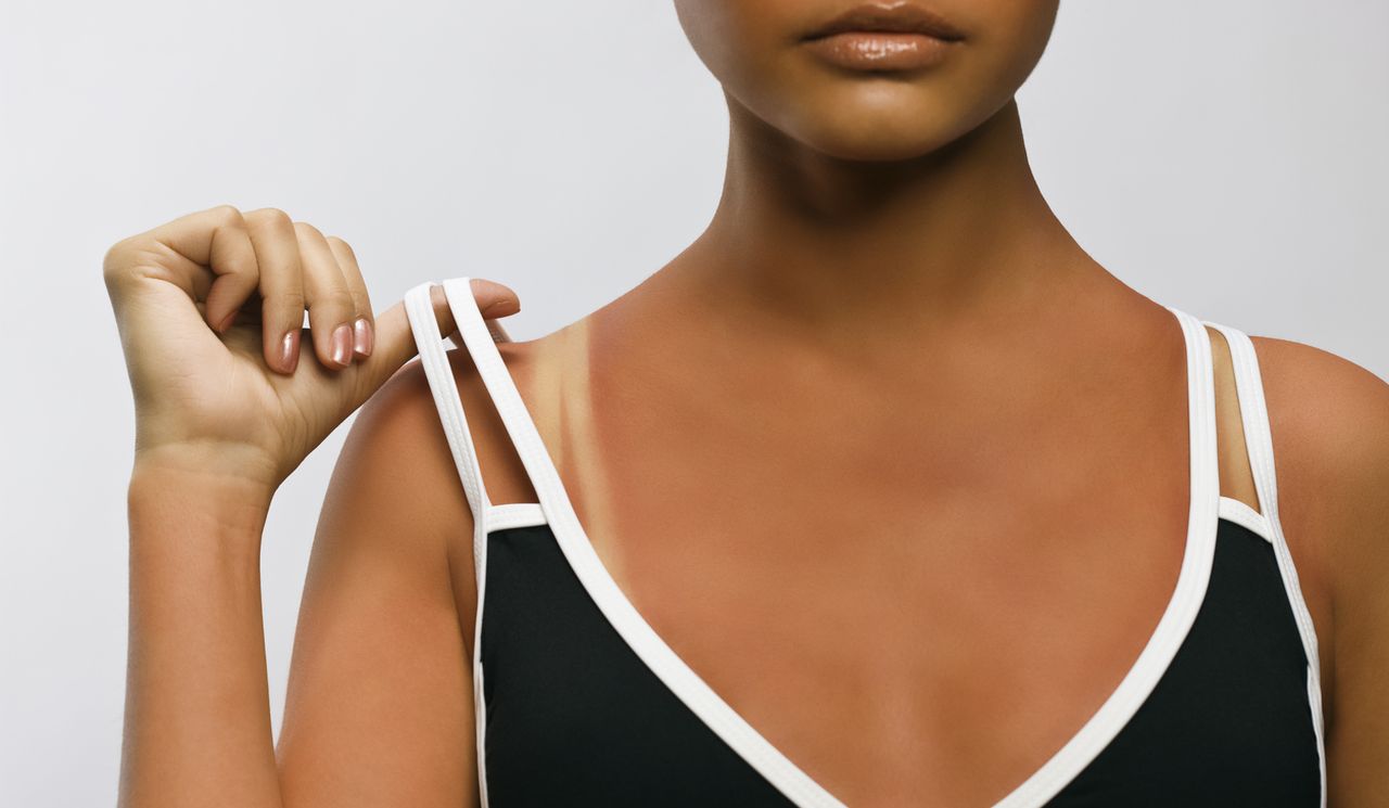 Бронзовият тен може да е симптом на рак