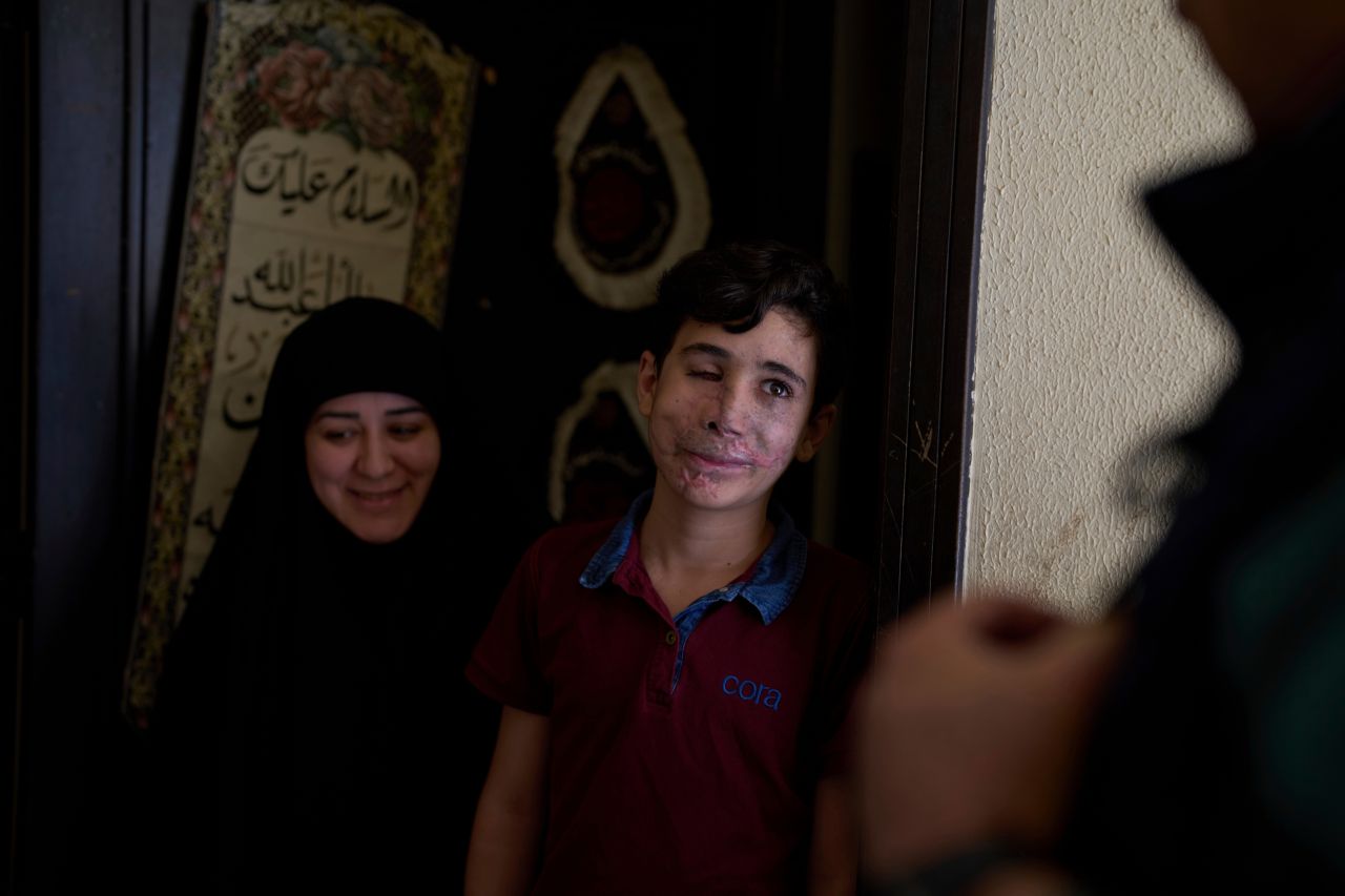 <p>12-годишният Хюсеин Дхейни, ранен при атаката с пейджъри, извършена от Израел на 17 септември 2024 г., стои до майка си, Фатен Хайдар, на входа на дома им в село Тейр Деба, южен Ливан, на 1 май 2025 г.</p>