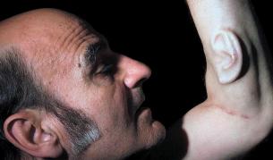 Мъж с три уши вече не е фантастика