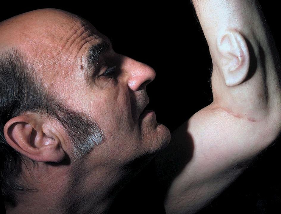 Мъж с три уши вече не е фантастика