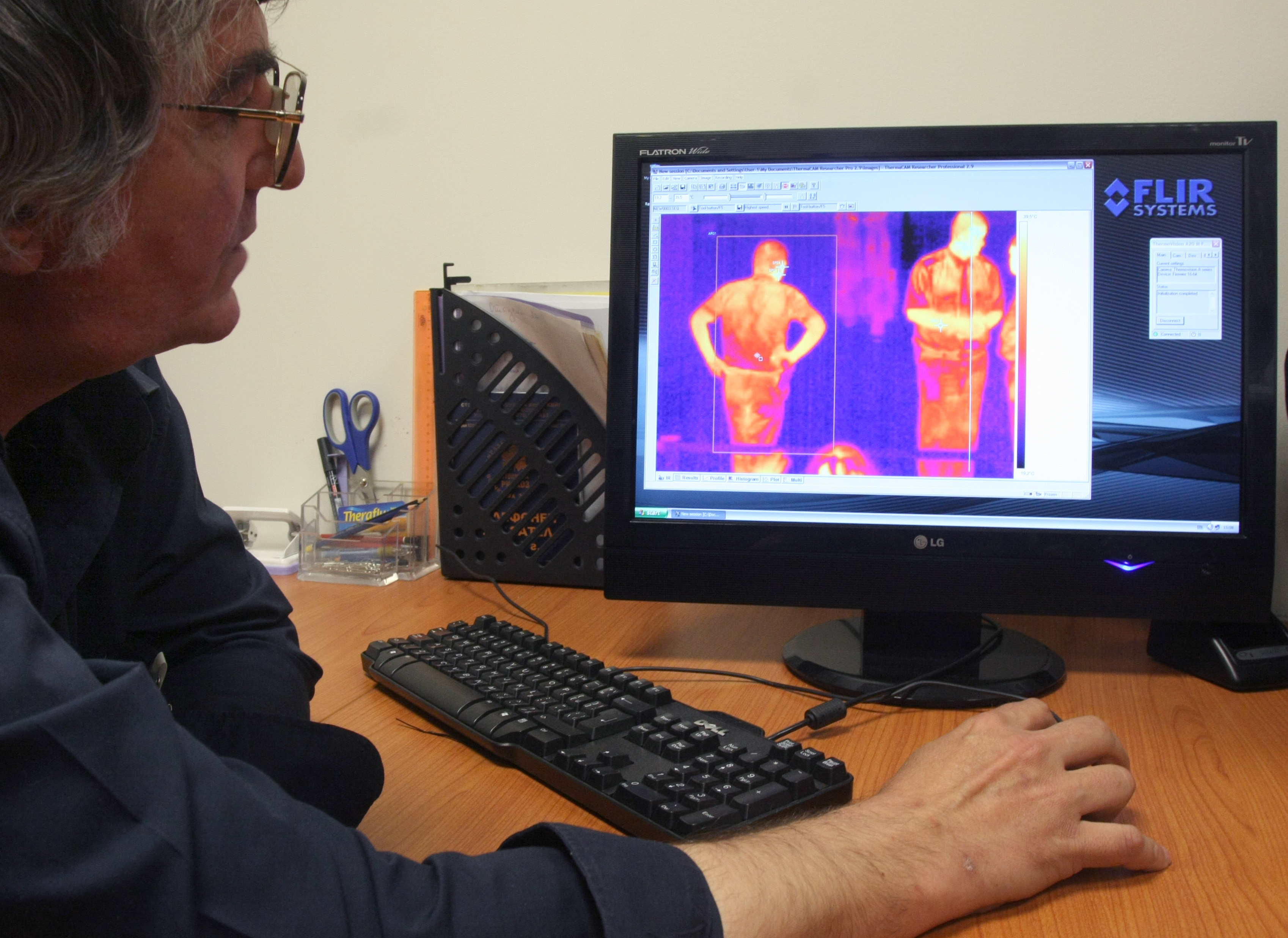 Дете от Благоевградско е вторият пациент със свински грип у нас