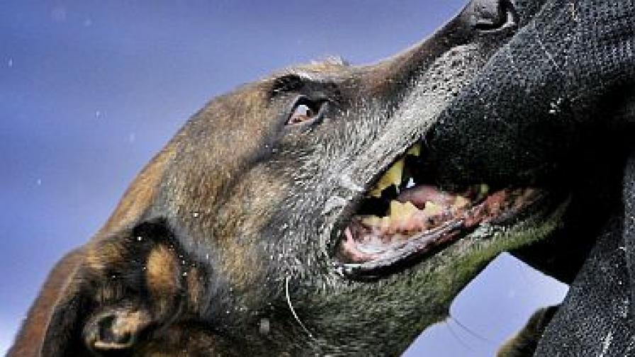 37-годишна нахапана жестоко от куче в София