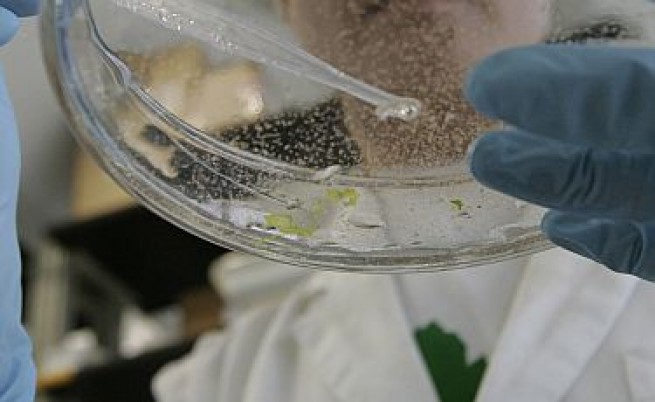 Връзка между Омега-3 и рак на простатата