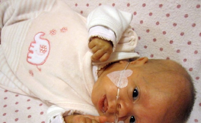 Фолиевата киселина понижава риска от аутизъм за бебето