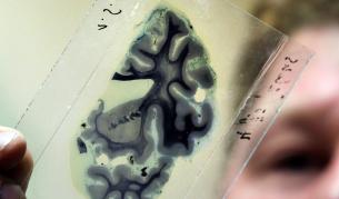 Нова технология ще препрограмира клетки в неврони