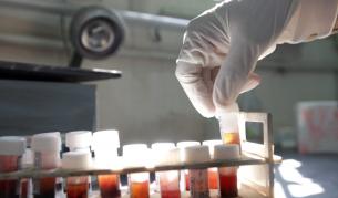 30 години от откриването на вируса ХИВ 