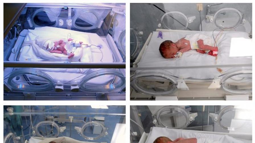 Намалява броят на раждания на повече от 2 близначета в САЩ